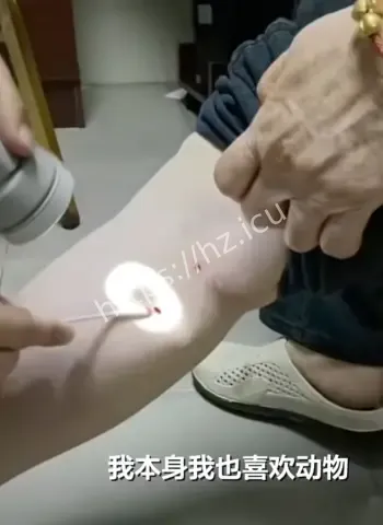 业主遛狗狗扑咬老人