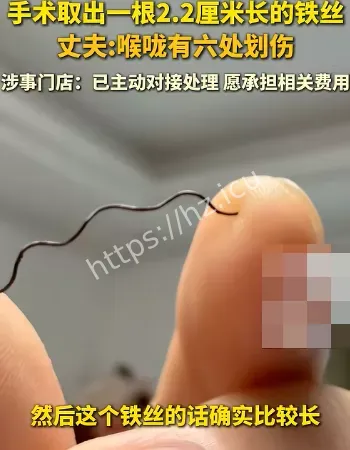 女子误食2.2厘米长铁丝