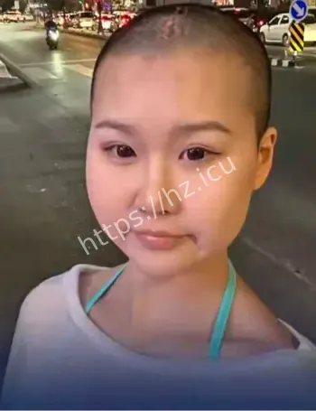 刘巧抗癌毕业