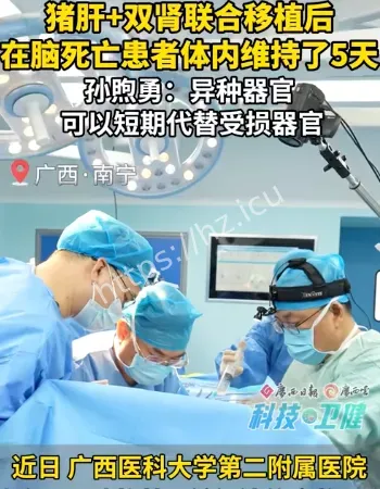 猪肝猪双肾移植