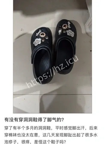 雨天穿洞洞鞋闷出脚气