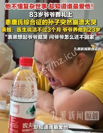 唐氏患者葬礼上大哭