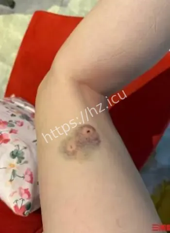 女子乐园被大狗撕咬